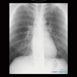 金属バット無問題　友保の胸部実寸スケルトンTシャツ
